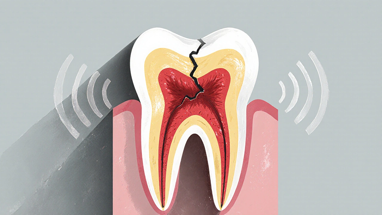 Příčný řez zubem ukazující šíření praskliny od skloviny k pultu.