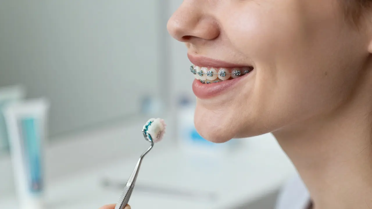 Zničené zuby po rovnátkách: Jak je obnovit a zabránit dalšímu poškození?