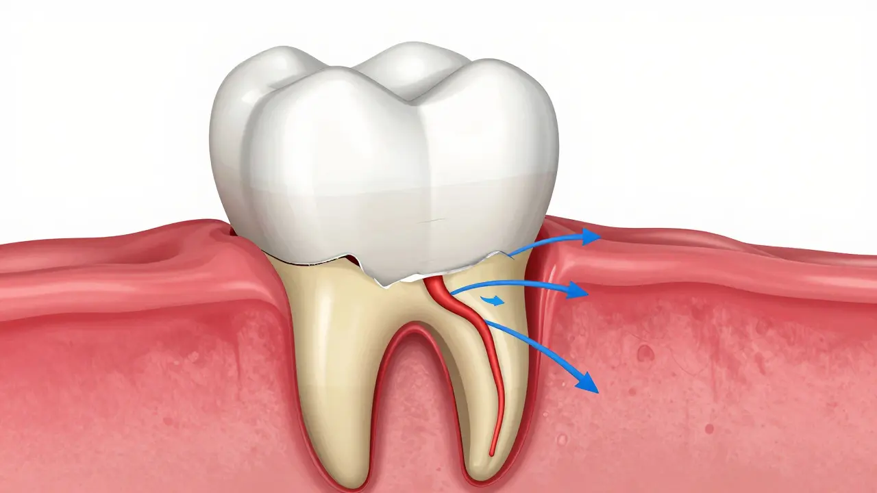 3D řez zubem ukazující odhalený dentin a nervy citlivé na chlad
